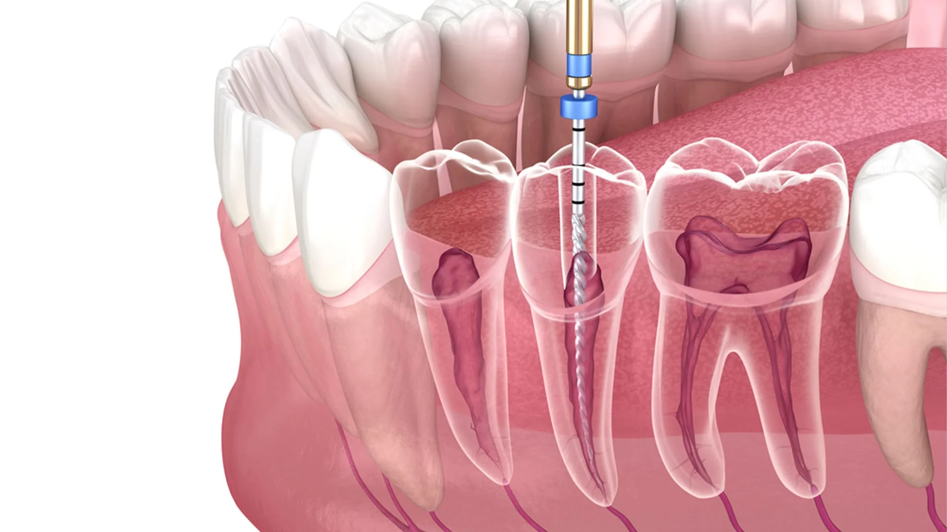 COVID-19 Update/Sterilization - River Valley Endodontics