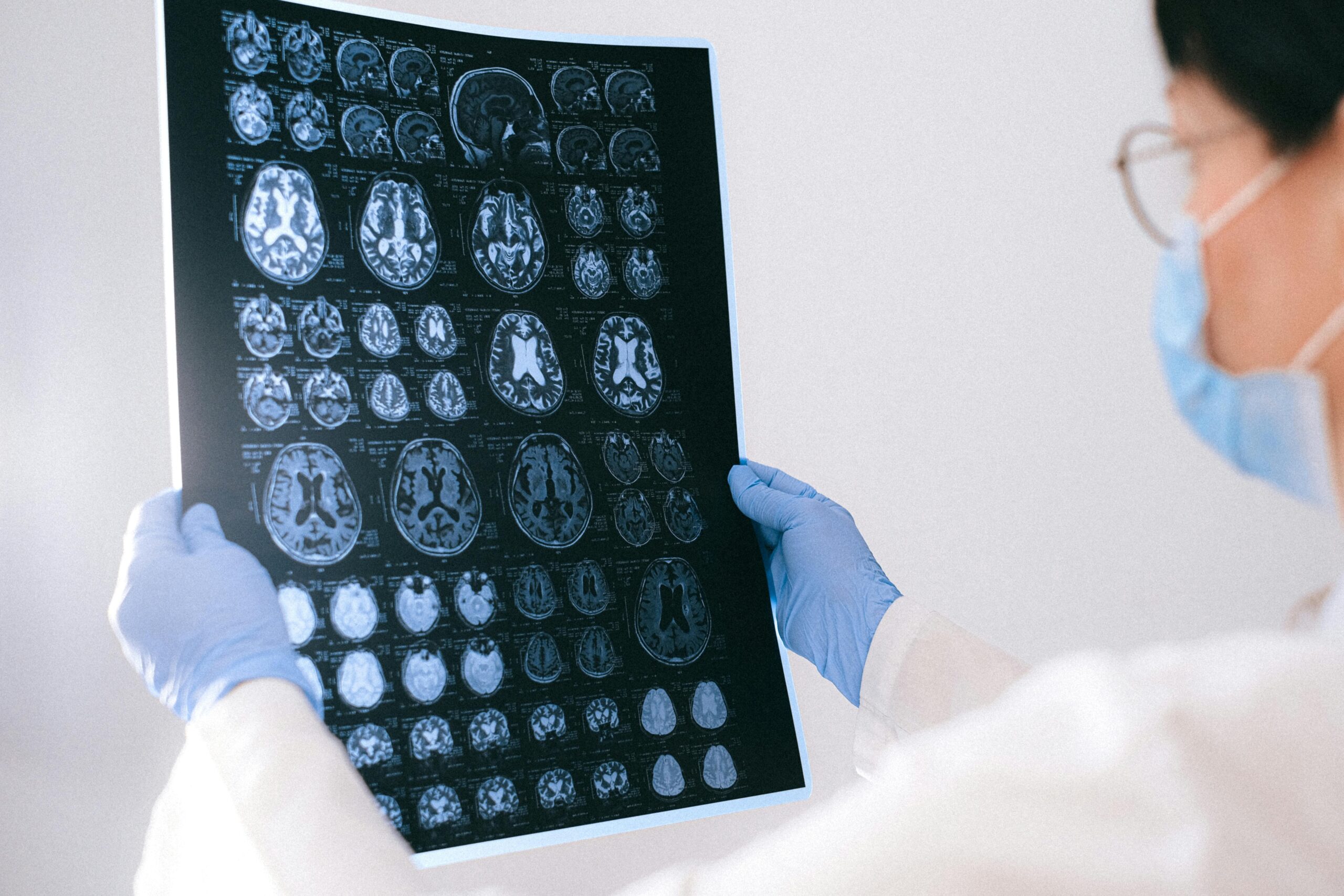 A healthcare professional wearing blue gloves holding a large sheet of brain MRI scans