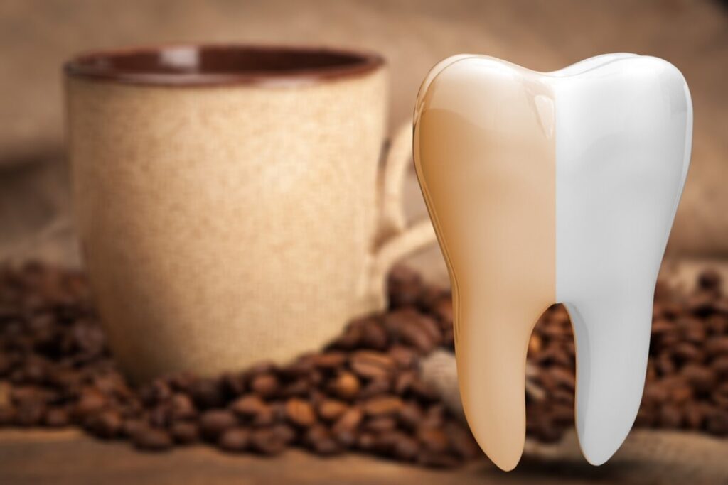 A close-up of a tooth model showing discoloration on one side