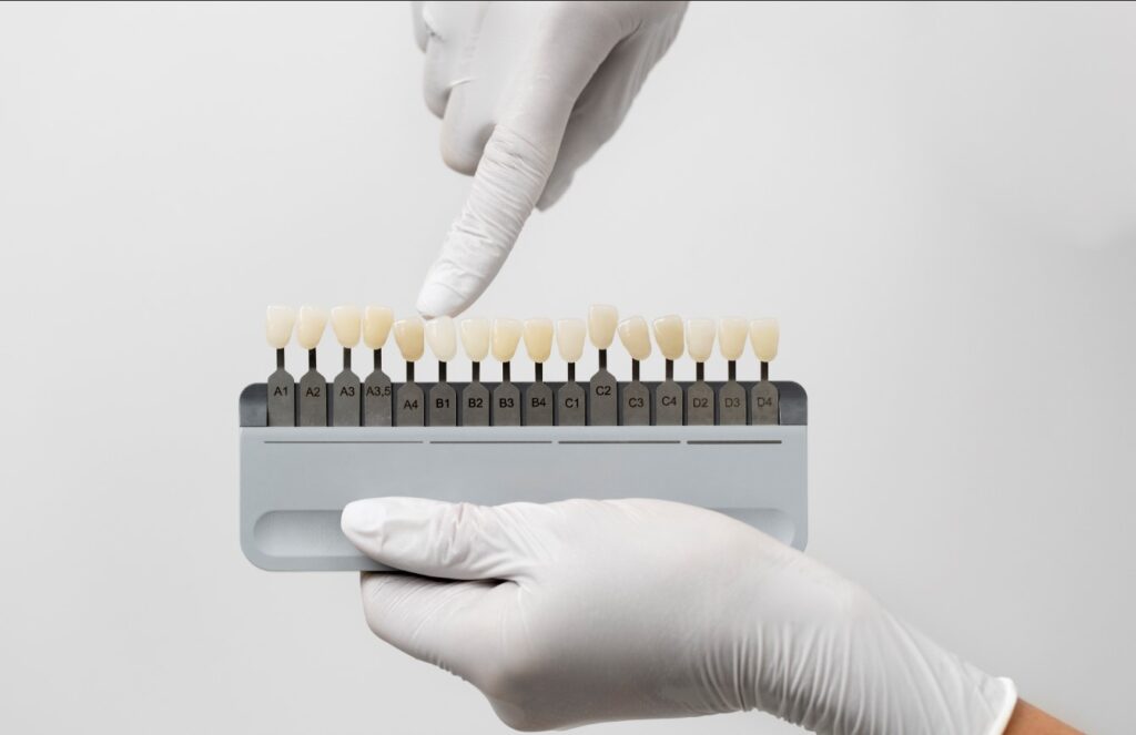A gloved hand pointing to a shade guide used for matching tooth color.