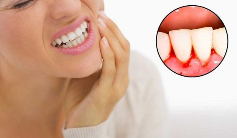 A woman holding her cheek in pain, with an inset image showing inflamed gums and swollen tissue around the teeth
