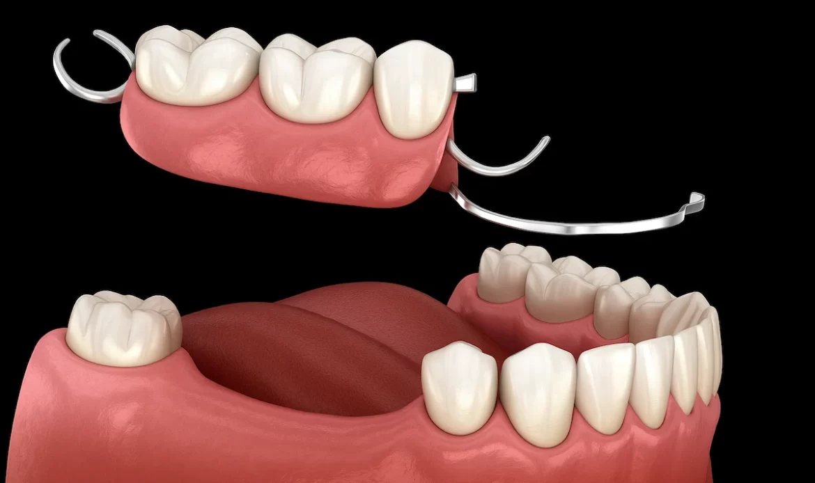 A 3D model showing the before and after effects of orthodontic treatment, highlighting the alignment of teeth