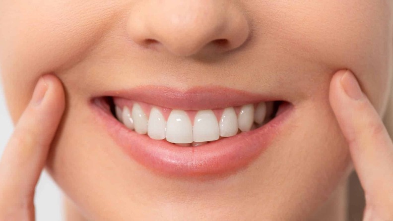 Close-up of a smiling woman showing white, healthy teeth with fingers pointing to her cheeks.