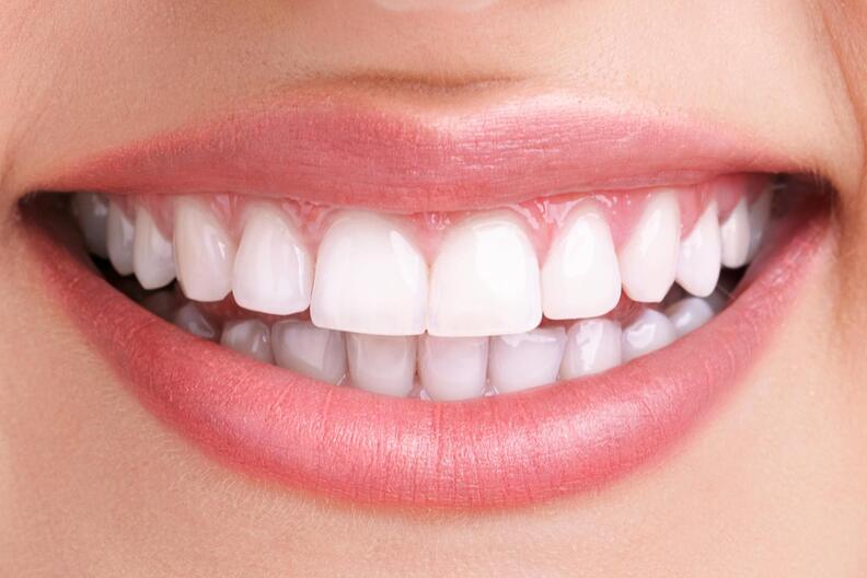 Close-up of a bright smile showing clean, white teeth and healthy pink gums.
