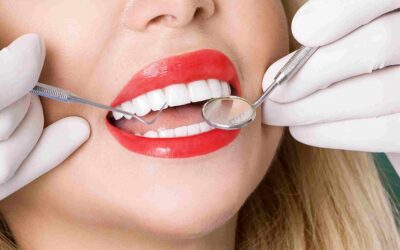 Hollywood Smile in Abu Dhabi: Procedure, Cost, and Benefits