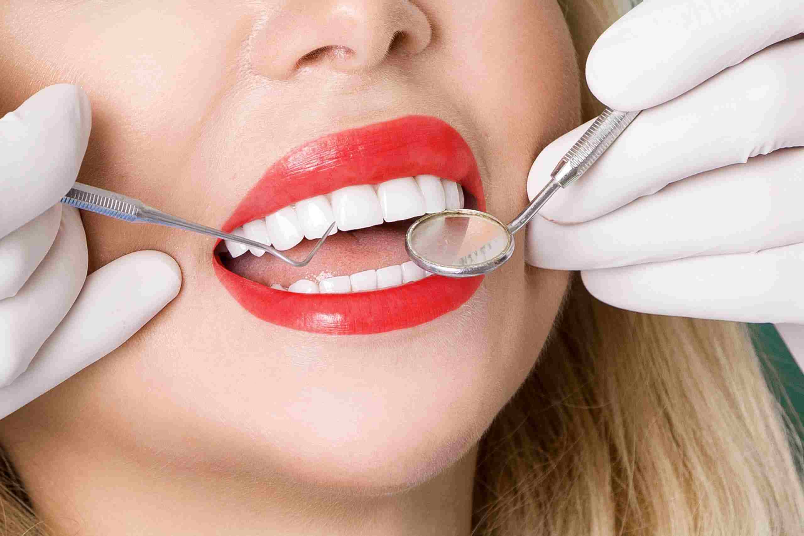 Hollywood Smile Get the Perfect Hollywood Smile in Abu Dhabi: Procedures, Costs, and Benefits