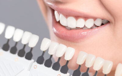 Nano teeth whitening vs. Zoom whitening