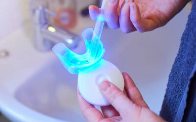 At-home nano teeth whitening kits: do they really work?