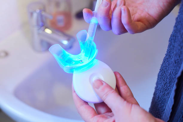 At-home nano teeth whitening kits: do they really work?