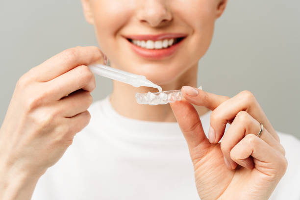 Woman applying whitening gel into a clear dental tray before starting an at-home nano teeth whitening treatment.