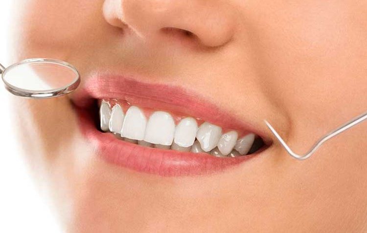 Close-up of a patient’s smile during a dental checkup, showing white teeth and a dental mirror near the mouth