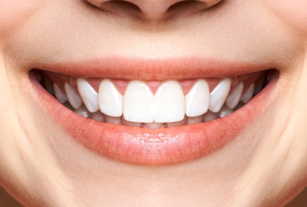 385fe60f-2bfd-44d9-9ca5-0113c2ce2a95-c4de1123-1d90-42de-b0d1-ba4ed3bebca0-woman-teeth-before-after-whitening-image-symboliz