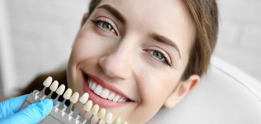 Smiling woman at a dental clinic comparing her tooth shade with a color guide held by a dentist wearing blue gloves.