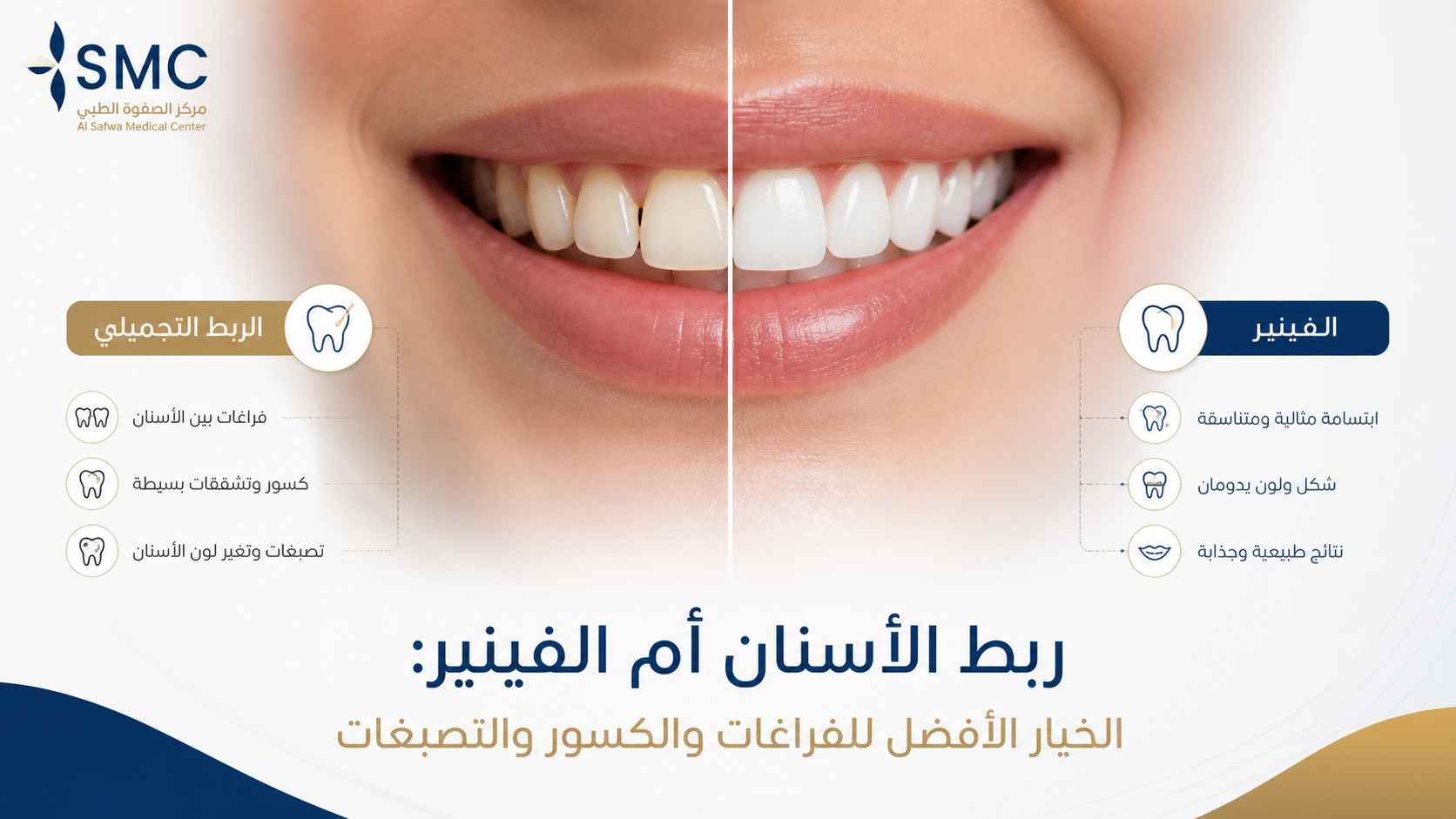 ربط الأسنان أبوظبي